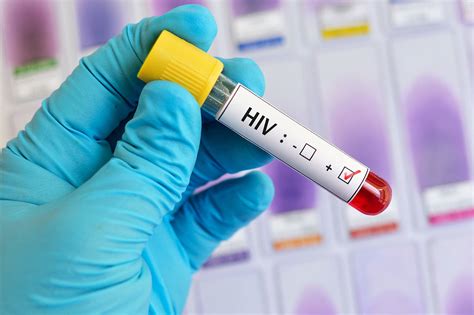 FAQ: Правда ли, что ВИЧ-инфицированные, которые пьют лекарства, не заразны?