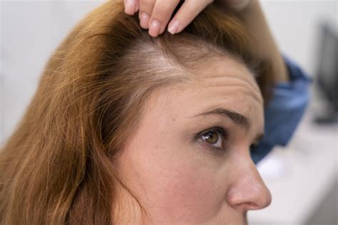 The Best Shampoo for Shedding Hair, According to a Licensed Cosmetologist