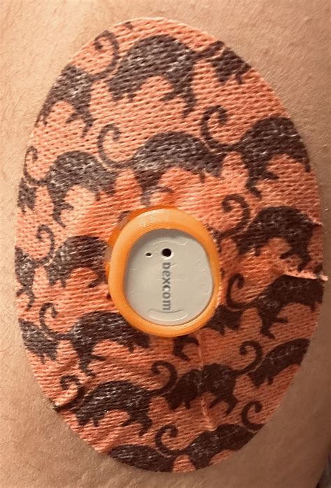 dexcom g6 needle size 1