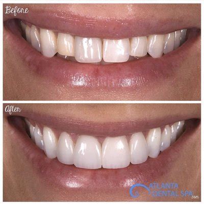 ATLANTA DENTAL SPA - Updated May 2024 - 39 Photos & 30 Reviews - 664 N ...