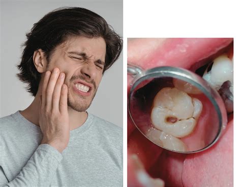 dental emergency  montreal emergency dentist