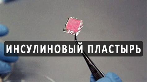 Умный инсулиновый пластырь для безболезненного лечения диабета - YouTube