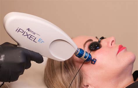 Pixel Skin Resurfacing — Bare Envy Laser, Skin & Massage