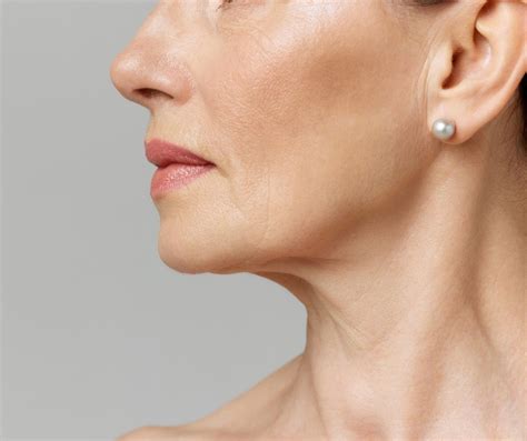 exion treatment north dallas dermatology associates