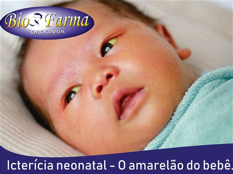 O Que E Amarelao - Drogaria Biofarma - Icterícia neonatal: o que é, causas e como tratar o ...