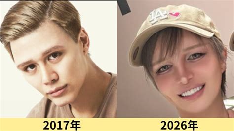 Mattの顔変わった？変化を2026現在画像まで時系列！鼻やおでこも | 顔変わった？芸能人オタクのビジュアル考察室