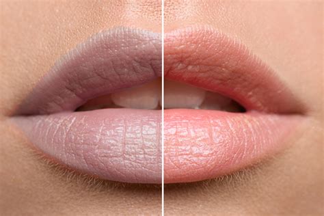 fed    dark lips   foods     rid