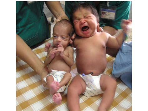 prematurity  iugr pptx