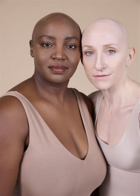 Alopecia Project — Tilly Nelson Commercial Lifestyle & Kids Fashion