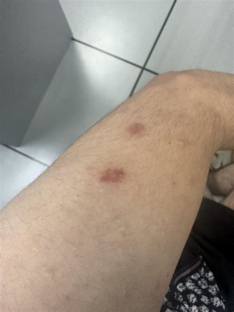 happened when i was sleeping, could it be bed bugs? also have a similar