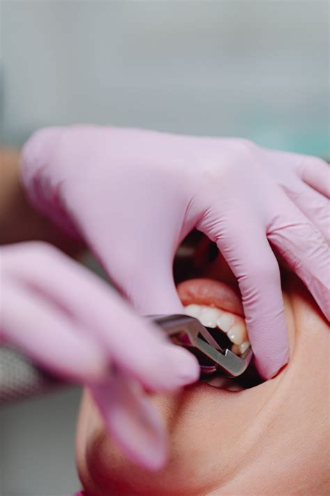 Exploring the Dental Hygienist Career in the USA - Future Skills