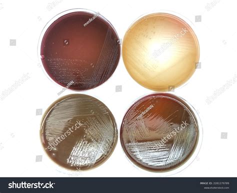 Proteus Mirabilis Colonies Macconkey Agar Plate Stockfoto 2281279789 ...