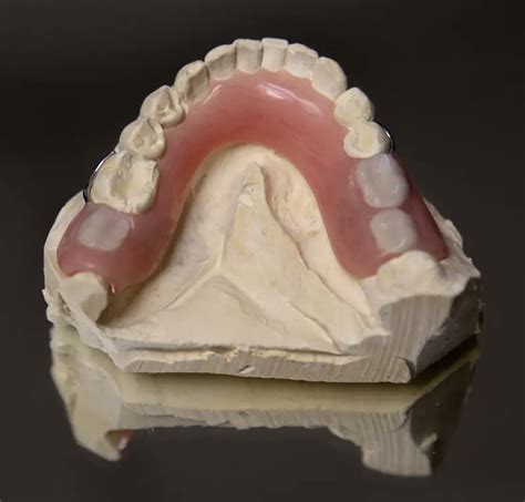 acrylic partials affordable  customizable denture crafters