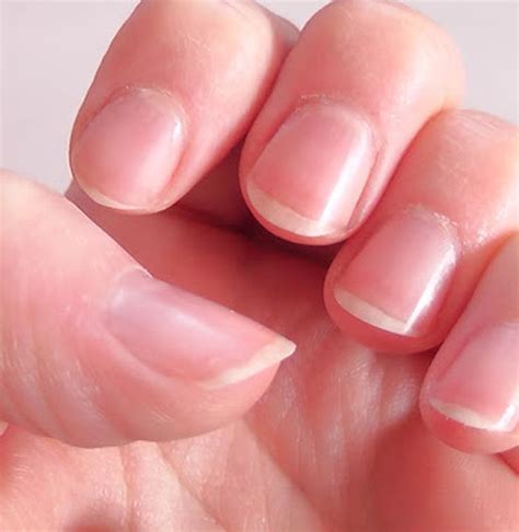 berita fakta seputar kuku terbaru hari  bobo