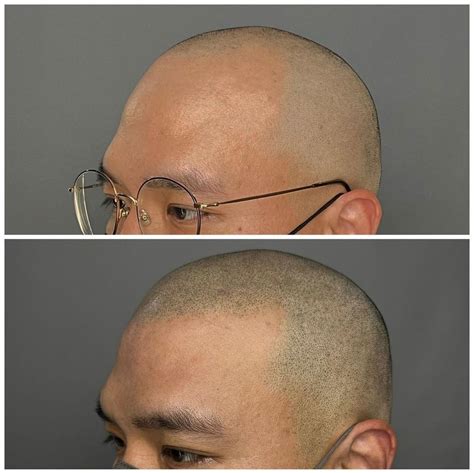 スカルプタトゥーとの出会い | scalp tattoo_cheuda-osakaのブログ