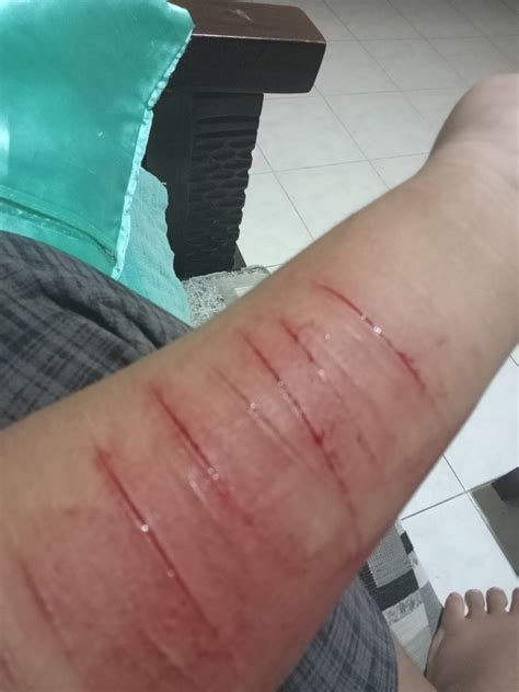 kecanduan hellosehat