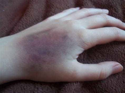 The Art Of Imperfect Beauty: 5 Steps To Creating Realistic Bruises