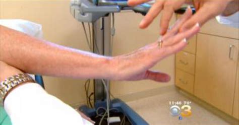 Health: Quick Treatment Growing In Popularity For Pain Relief - CBS ...