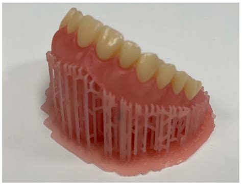 Adhesion of Conventional, 3D-Printed and Milled Artificial Teeth to