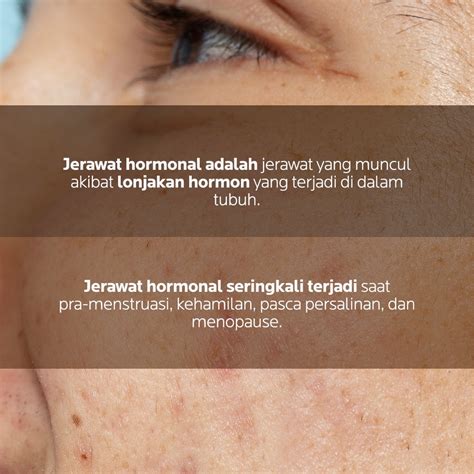 AIZEN DERMALOGY | Di Skin School kali ini, Minzen akan membahas tentang ...