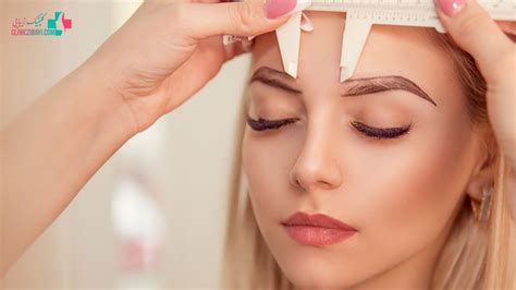 سیخ شدن ابرو بعد از کاشت و علت آن - کلینیک زیبایی