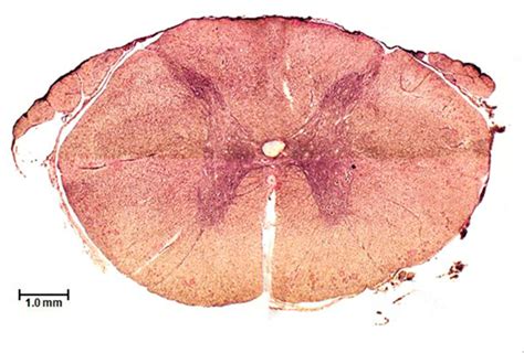 Spinal cord histology Diagram | Quizlet