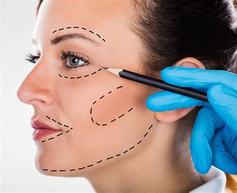 face lift reviveskin medical spa