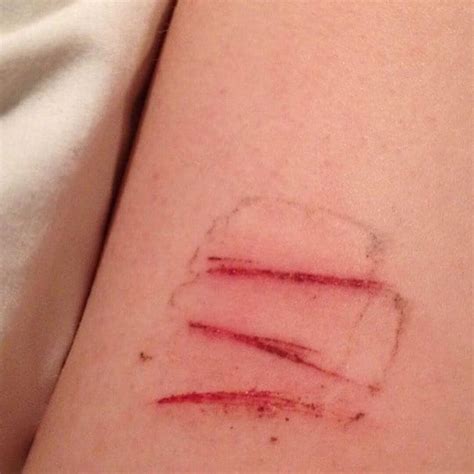 adolescents engage   harm  cutting