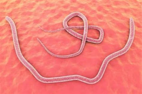 Why do roundworms grow in the human body | Longevity