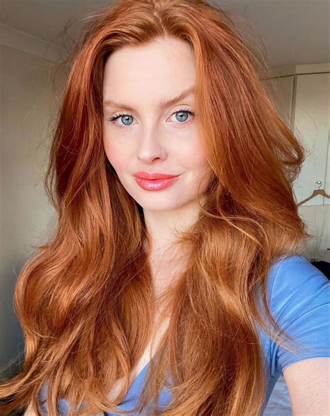 RedheadsDaily