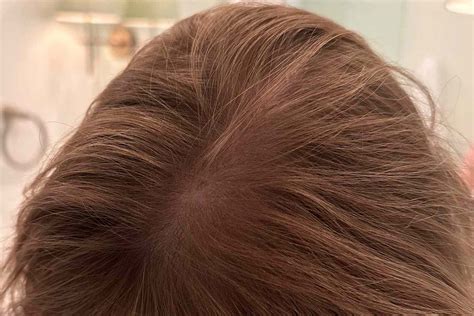 The 12 Best Shampoos for Thinning Hair of 2025, Tested and Reviewed