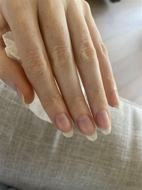 how to prevent hangnails 4
