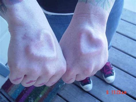 Implants - Body Piercing & Modification