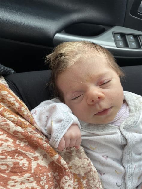 My little one is born with 2 toned hair! I just googled it and it seems