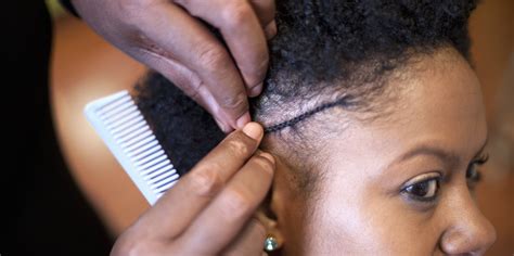 What Is Traction Alopecia? | PS Beauty