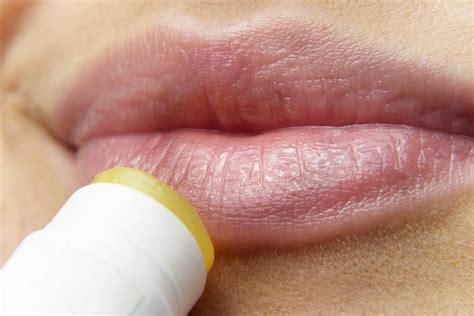 reason   chronically dry lips