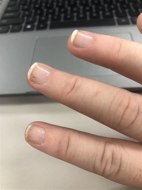 What are these little black lines? They’ve been appearing on a bunch of ...