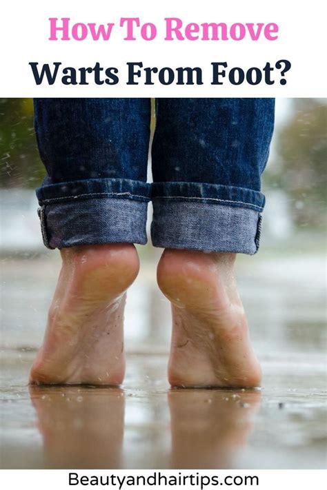 how to remove foot warts at home