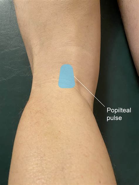 Popliteal Pulse Landmark Anterior Tibial Artery Anatomy, Course,