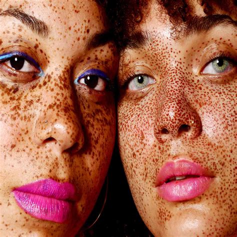 how to remove the freckles 7