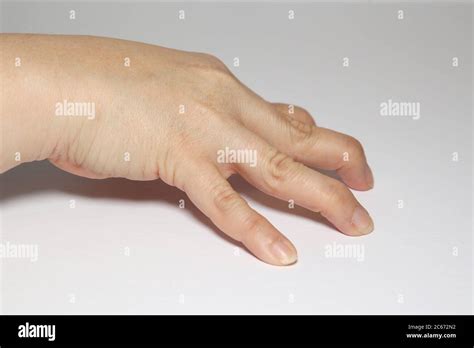 doppelgelenkiger finger fotos und bildmaterial  hoher aufloesung alamy
