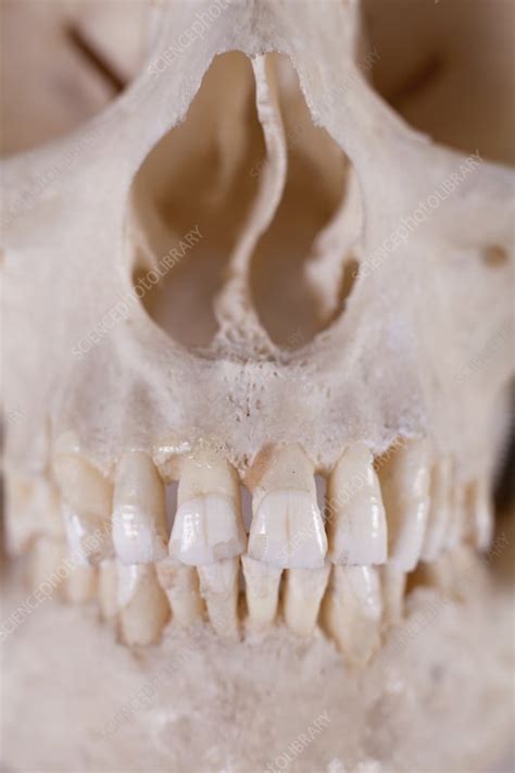 Human Skull detail - Stock Image - C024/4556 - Science Photo Library