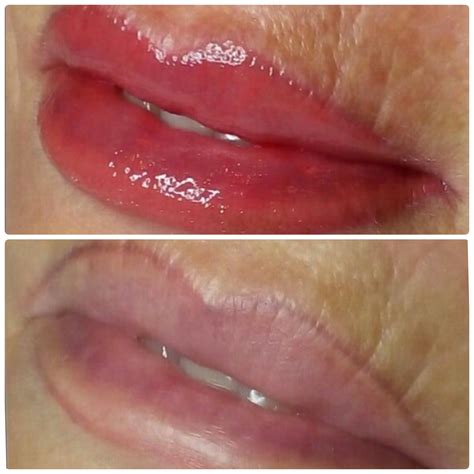 Micropigmentación Labios - Micropigmentación y Microblading en Coruña