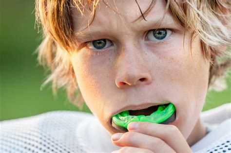 CUSTOM MOUTHGUARDS IN CANBERRA - Evolving Smiles