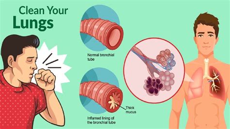 brown mucus  lungs sputum contents function conditions colors