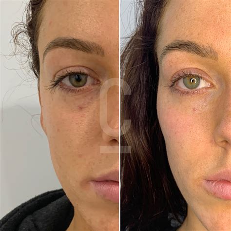 naturally defined cheekbones
