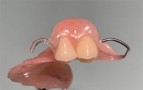 Partial Dentures with Clear Flexible Clasps