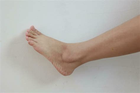 leg  white background  stock photo  vecteezy