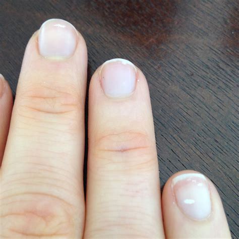 White Spots On Toenails After Removing Nail Polish
