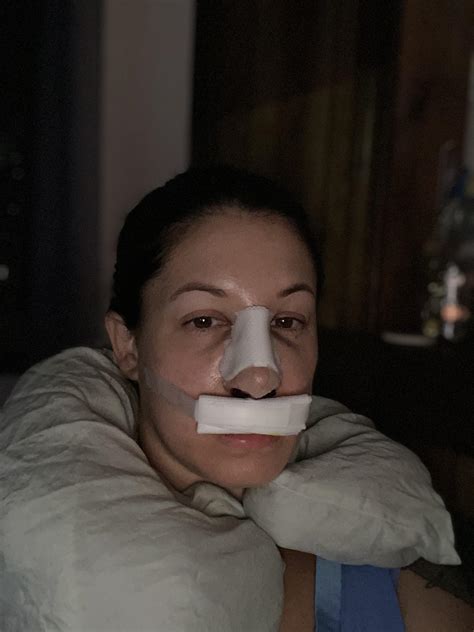 Day one. Swelling has exploded in my cheeks. Tons of mucus in throat